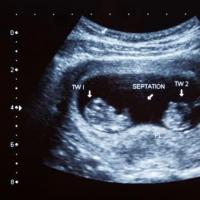Восьмая акушерская неделя беременности: что происходит в организме матери и плода